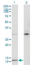 Anti-MTCP1 Mouse Monoclonal Antibody [clone: 1G12]