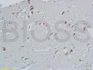 Anti-CXCL13 Rabbit Polyclonal Antibody