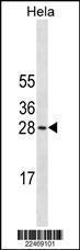 Anti-COMT Mouse Monoclonal Antibody [clone: 630CT1.7.1]