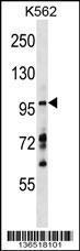 Anti-MYRIP Rabbit Polyclonal Antibody (HRP (Horseradish Peroxidase))