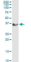 Anti-CFHR1 Polyclonal Antibody Pair