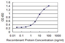 Anti-MTCP1 Mouse Monoclonal Antibody [clone: 1G12]