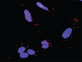 Anti-BIRC3 + TRAF2 Antibody Pair