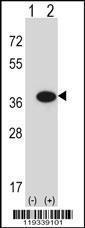 Anti-GMPR Rabbit Polyclonal Antibody