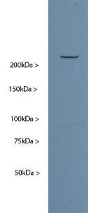 Western blot of developing rat brain (P18) homogenate probed with Anti-Nestin. A single strong band running at ~240 kDa is seen