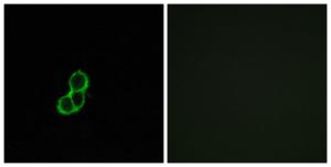 Immunofluorescence analysis of MCF7 cells using Anti-OR5T3 Antibody The right hand panel represents a negative control, where the antibody was pre-incubated with the immunising peptide