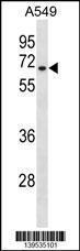 Anti-HAS3 Rabbit Polyclonal Antibody (Biotin)