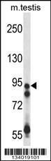 Anti-USP20 Rabbit Polyclonal Antibody (AP (Alkaline Phosphatase))