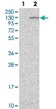 Anti-MTBP Rabbit Polyclonal Antibody