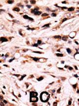 Anti-SMAD4 Rabbit Polyclonal Antibody