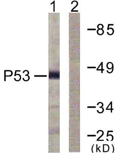 Anti-p53 antibody