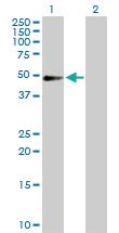 Anti-PDLIM7 Rabbit Polyclonal Antibody