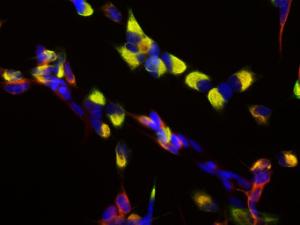 SH-SY5Y neuroblastoma cells were stained with Anti-Nestin Antibody (1:5,000 / red) and Anti-Vimentin (A85421 / 1:10,000 / green). Vimentin is main partner of nestin forming heterdimers and further polymerizing to form intermediate filaments.