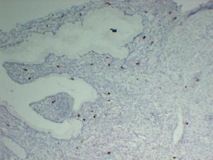 Immunohistochemical analysis of paraffin-embedded human Uterus using Anti-Mast Cell Tryptase Antibody