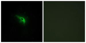 Immunofluorescence analysis of A549 cells using Anti-TPIP1 Antibody The right hand panel represents a negative control, where the antibody was pre-incubated with the immunising peptide