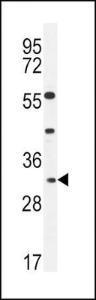 Anti-APOF Rabbit Polyclonal Antibody (AP (Alkaline Phosphatase))