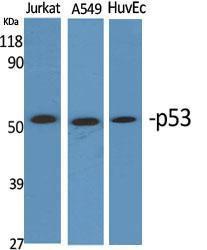 Anti-p53 antibody