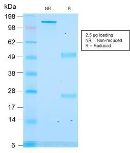 Antibody anti-ACTH RCLIP1418 100 µg