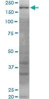 Anti-WRN Mouse Monoclonal Antibody [clone: 2F7]