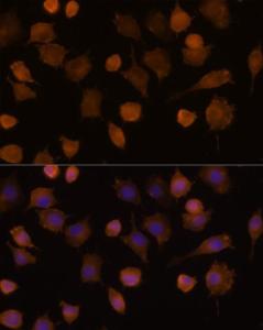 Immunofluorescence analysis of L929 cells using Anti-ICAM1 Antibody (A9725) at a dilution of 1:100 (40x lens) DAPI was used to stain the cell nuclei (blue)