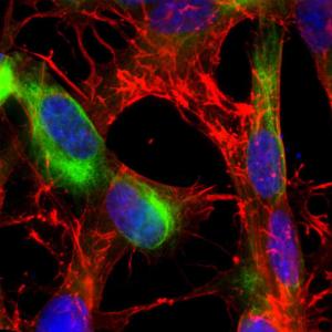 Immunofluorescent analysis of SH-SY5Y cell culture stained with Anti-Nestin Antibody (A85294), at a dilution of 1:3,000, in green, and co-stained with Anti-Actin Antibody (A85388), at a dilution of 1:500, in red. Blue is Hoechst staining of nuclear DNA.