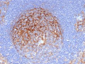 Anti-ICAM1 Mouse Monoclonal Antibody [clone: P2A4]