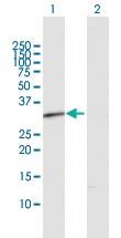 Anti-RDH12 Rabbit Polyclonal Antibody