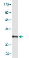 Anti-ABCB6 Mouse Monoclonal Antibody [clone: 3E1]