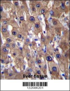 Anti-MAT1A Rabbit Polyclonal Antibody (HRP (Horseradish Peroxidase))