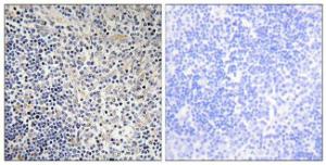 Immunohistochemical analysis of paraffin-embedded human thymus gland tissue using Anti-TPIP1 Antibody The right hand panel represents a negative control, where the antibody was pre-incubated with the immunising peptide