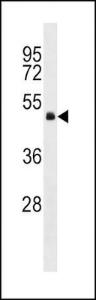 Anti-GNA13 Rabbit Polyclonal Antibody (AP (Alkaline Phosphatase))