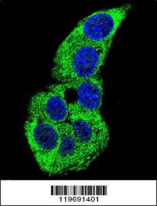 Anti-ACTG1 Rabbit Polyclonal Antibody