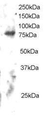 Anti-ELMO2 Antibody (A83692) staining (2µg/ml) of Human Brain lysate (RIPA buffer, 30µg total protein per lane). Primary incubated for 12 hour. Detected by chemiluminescence.