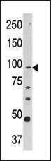 Anti-CPT1A Rabbit Polyclonal Antibody (AP (Alkaline Phosphatase))