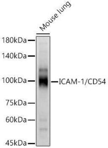 Western blot analysis of Mouse lung, using Anti-ICAM1 Antibody (A9725) at 1:3,000 dilution The secondary antibody was Goat Anti-Rabbit IgG H&L Antibody (HRP) at 1:10,000 dilution Lysates/proteins were present at 25 µg per lane