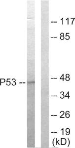 Antibody anti-P53 A98464-100 100 µg