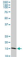 Anti-NUDT1 Rabbit Polyclonal Antibody