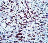 Anti-APOA5 Mouse Monoclonal Antibody [clone: 1G5G9]