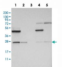 Anti-RP5-1000E10.4 Rabbit Polyclonal Antibody