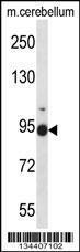 Anti-FBLN1 Rabbit Polyclonal Antibody (AP (Alkaline Phosphatase))