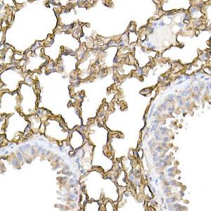 Immunohistochemistry analysis of paraffin-embedded mouse lung using Anti-ICAM1 Antibody (A9725) at a dilution of 1:100 (40x lens) Perform high pressure antigen retrieval with 10 mM citrate buffer pH 60 before commencing with IHC staining protocol