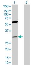 Anti-CACYBP Rabbit Polyclonal Antibody