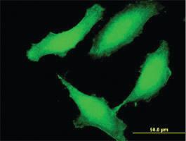 Anti-CCDC115 Mouse Polyclonal Antibody