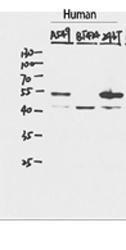 Antibody anti-P53 A98464-100 100 µg