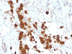 Immunohistochemical analysis of formalin-fixed, paraffin-embedded human pituitary using Anti-ACTH Antibody [SPM333]