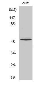 Western blot analysis of various cells using Anti-MMP17 (cleaved Gln129) Antibody