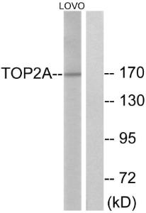 Anti-Topoisomerase II alpha+Topoisomerase II beta Rabbit Polyclonal Antibody