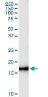 Anti-NUDT1 Rabbit Polyclonal Antibody