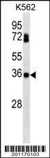 Anti-CSNK2B Mouse Monoclonal Antibody (PE (Phycoerythrin)) [clone: 260CT10.1.1]