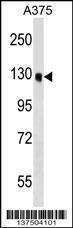 Anti-OSBPL6 Rabbit Polyclonal Antibody